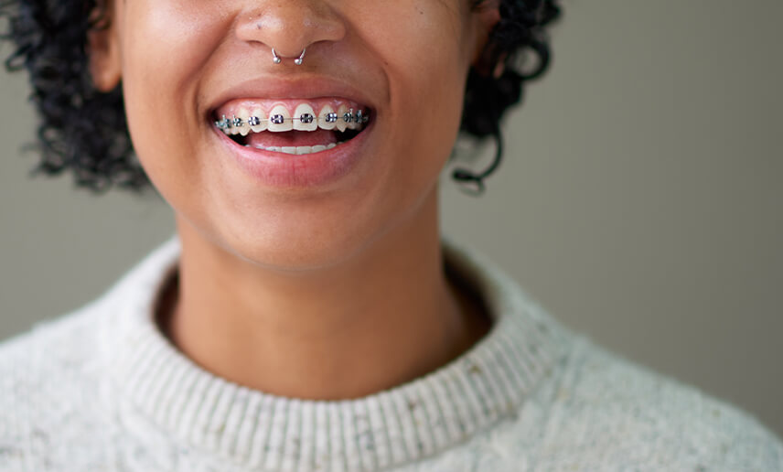 Are Braces Covered by Medicare or Health Funds? Your Guide to Orthodontic Rebates in Australia