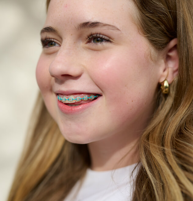 Can I still choose colours with my clear braces?