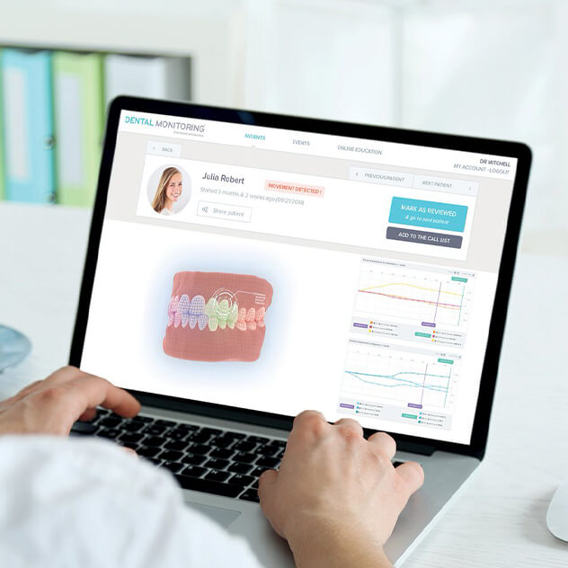 What is Dental Monitoring?