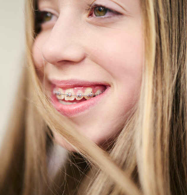 Have another question about eating with braces?