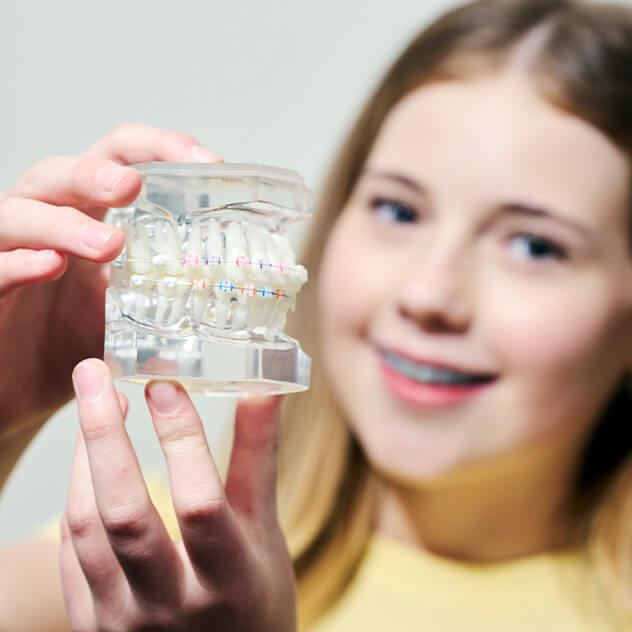 How do clear braces work?